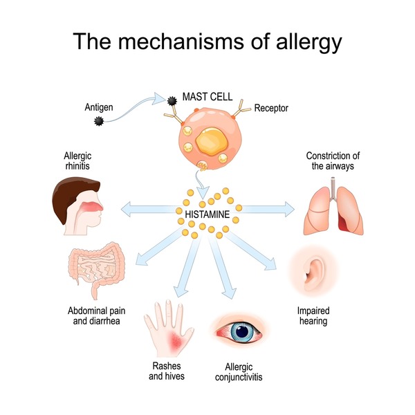 Illustration showing how allergens work